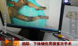 多毛阴户视频,私密部位的生理与美学探讨